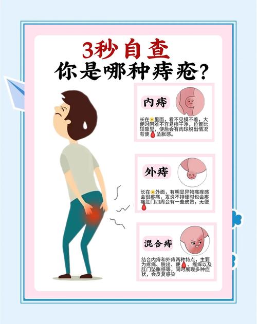 “蹲便”VS“坐便”，哪个更容易让人长痔疮？