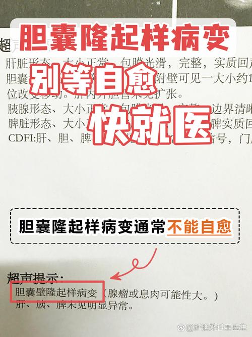胆囊癌在我国发病率呈上升趋势 早期诊断很关键