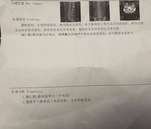 浙江27岁新手妈妈突然确诊！医生：比80岁老太太的还差