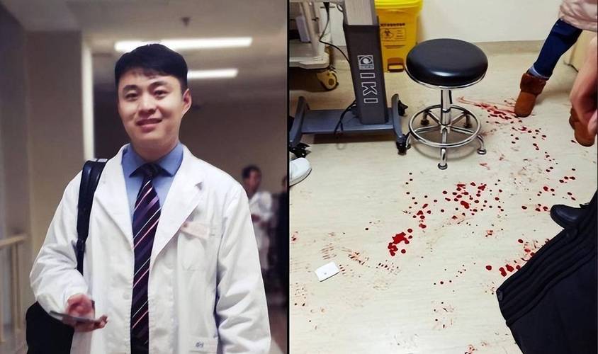 起跳争夺篮板球,小伙落地时却扭伤了脚,反复疼痛几天后医生为他动了刀